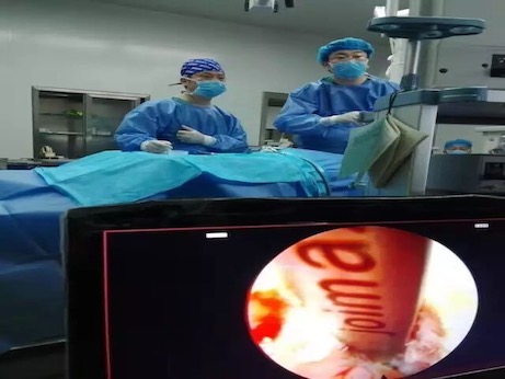 双色球成功完成辽宁省首例颈胸椎间孔镜手术