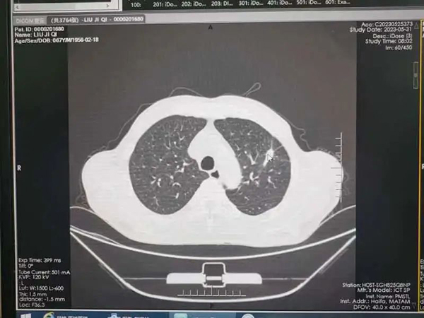 优势技术｜精准治疗 定点清除 CT引导下微波消融术给肺癌患者带来新希望